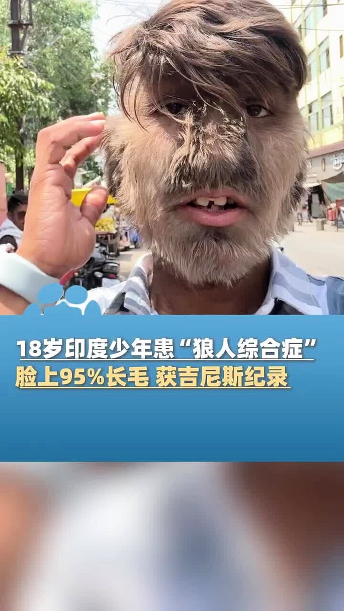 超碰爱爱人妻的相关介绍